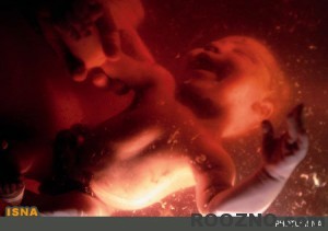 abbortion-lead-1